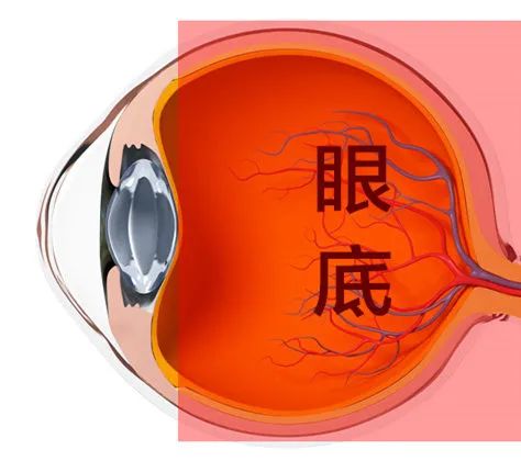 眼底检查到底有没有必要？